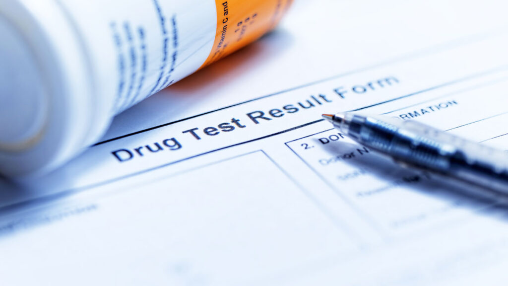 What Happens If I Fail a Drug Test on Probation in Texas